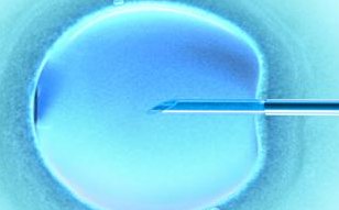 试管婴儿采卵无痛的真相是什么？采卵真的无痛吗？